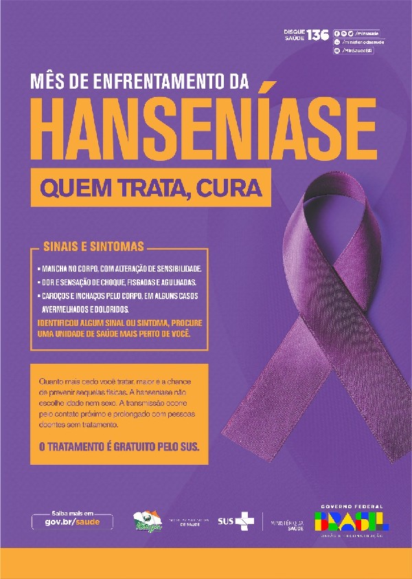 Janeiro Roxo marca o combate à hanseníase - Secretaria da Saúde